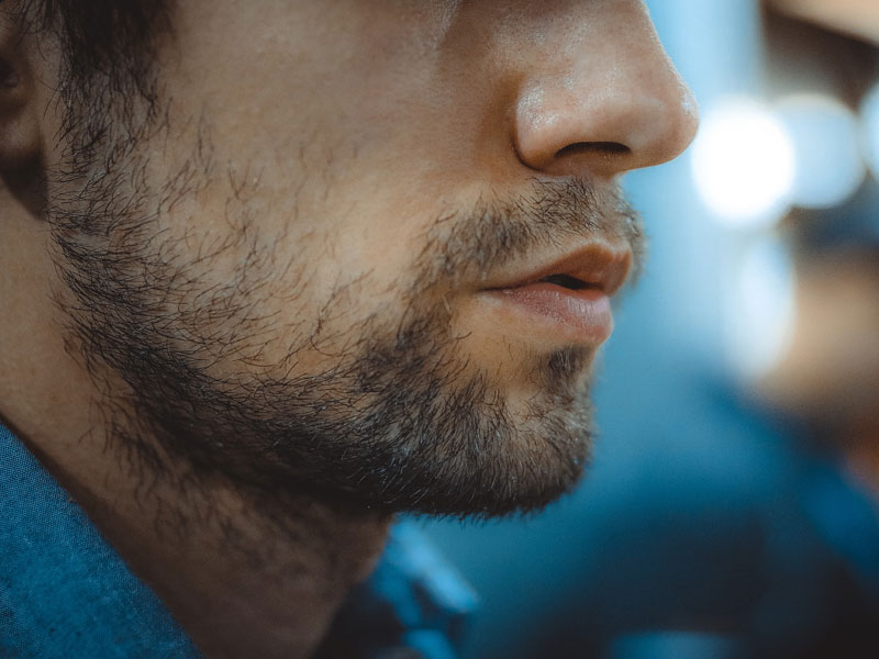 Hair removal for men illustrated with a man's hairy face